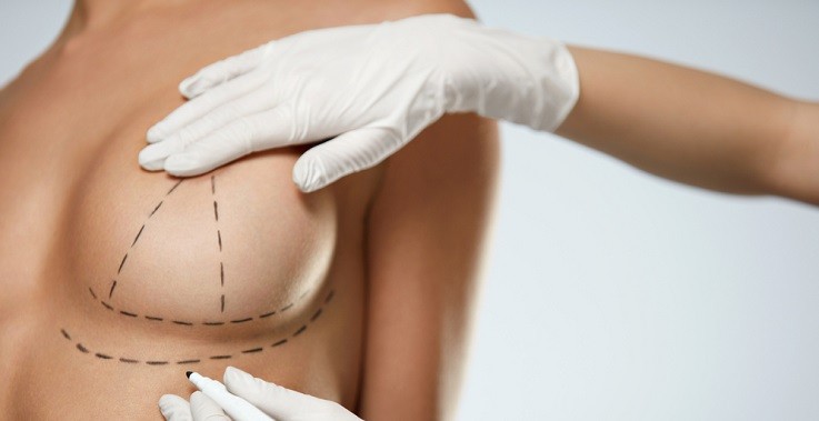 Фокус на грудь: лучшие специалисты Алматы по маммопластике