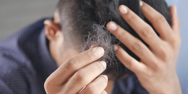 Как предотвратить раннее выпадение волос у мужчин?