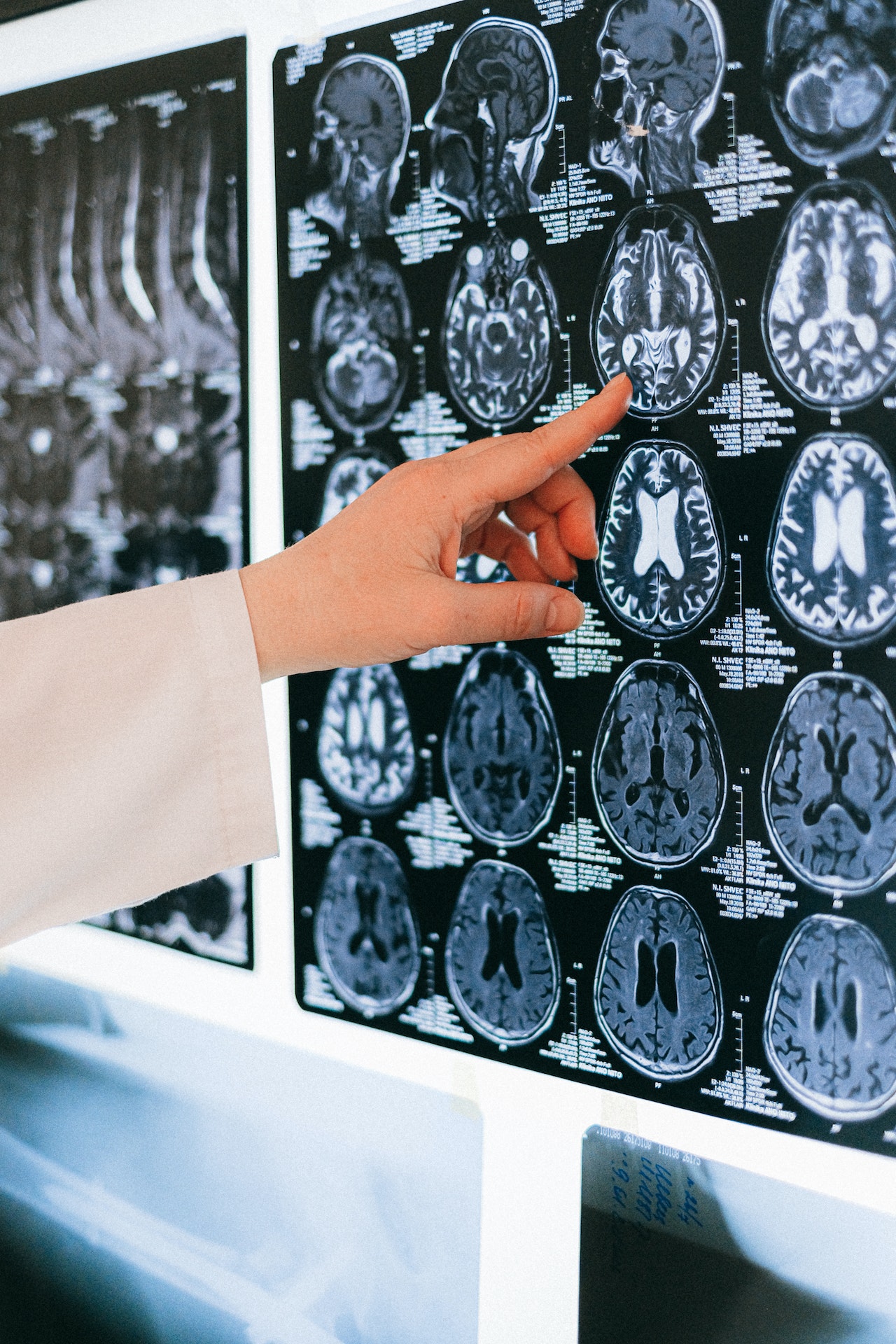 Тренировки для мозга: 8 способов добиться прояснения в голове