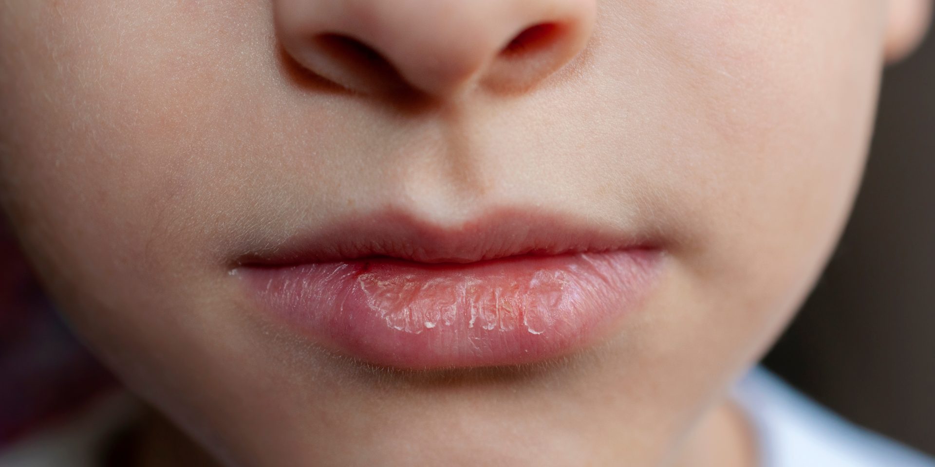 Разбираемся: могут ли губы потрескаться из-за бальзама?